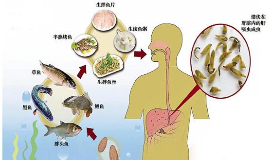 吃生鲜同患肝吸虫病肝吸虫病是由于人体摄入含有肝吸虫囊蚴的生鲜食物（如鱼生、虾生等）而导致的寄生虫病。其主要症状包括乏力、食欲减退、消化不良、腹痛等。因此，吃生鲜食品确实有可能导致肝吸虫病。